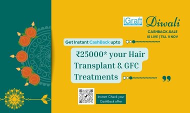 iGraft's Diwali 2023 unmissable Offer on the Best Hair Transplant & GFC Treatments: Latest Offers on Hair Transplant by leading chain of clinics iGraft in India.