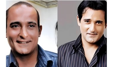 The Secret Behind Bollywood’s Perfect Hair Why Hair Patches Are Becoming the Go-To Solution